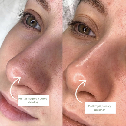 NUEVO DUO SERUM EXFOLIANTE CUIDADO FACIAL